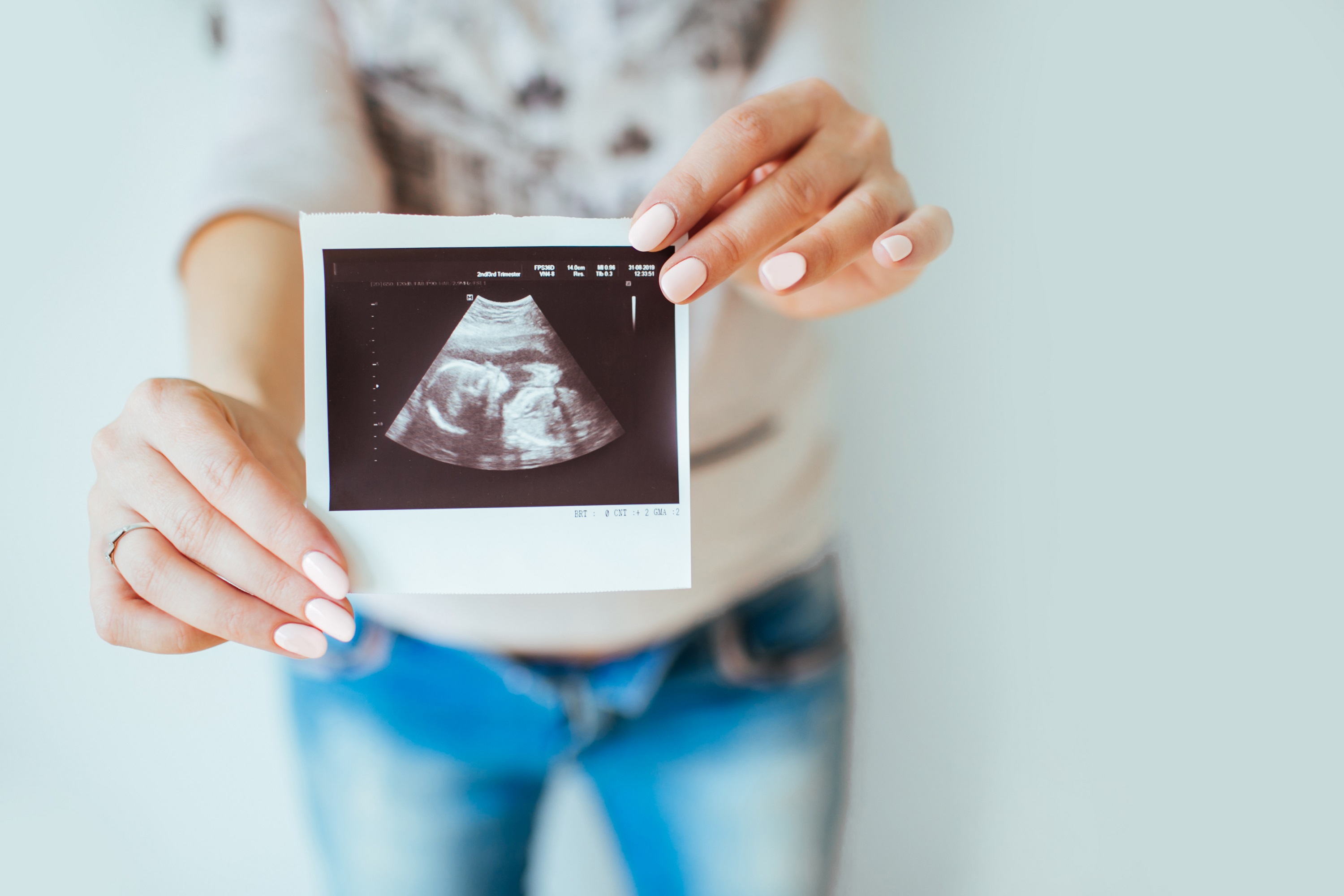 PL do Aborto: Forte rejeição e apoio surpreendente na Câmara dos Deputados